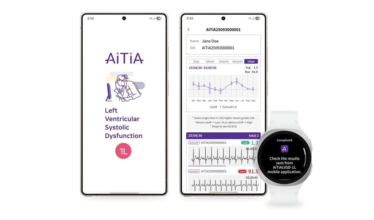 Samsung, yakında akıllı saat aracılığıyla kardiyovasküler durum tespitini detaylandırıyor. - Tekno Muaz